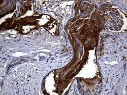 Invitrogen Carboxypeptidase M Monoclonal Antibody (OTI4E11) 100 &mu;L;