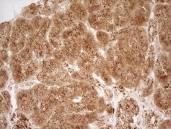 Invitrogen Renin Monoclonal Antibody (OTI2F10) 100 &mu;L | Buy Online | Invitrogen&trade; | Fisher Scientific