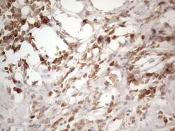 SFRP2 Monoclonal Antibody (OTI6E1):Antibodies, Monoclonal