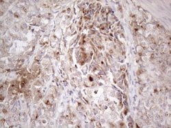 SFRP2 Monoclonal Antibody (OTI6E1):Antibodies, Monoclonal