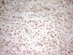 Invitrogen HSF2 Monoclonal Antibody (OTI2A7) 100 &mu;L; Unconjugated:Antibodies,