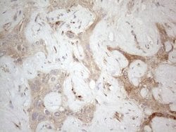 LOXL2 Monoclonal Antibody (OTI8G5):Antibodies, Monoclonal