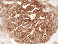 Invitrogen SFRP2 Monoclonal Antibody (OTI6C2) 100 &mu;L; Unconjugated:Antibodies,