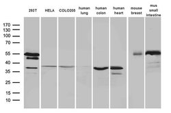 Invitrogen SFRP2 Monoclonal Antibody (OTI6C2) 100 &mu;L; Unconjugated:Antibodies,
