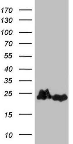Invitrogen eIF1AY Monoclonal Antibody (OTI2G2) 100 &mu;L; Unconjugated:Antibodies,