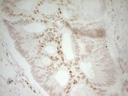 Invitrogen MEF2D Monoclonal Antibody (OTI3D12) 100 &mu;L; Unconjugated:Antibodies,