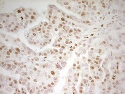 Invitrogen MEF2D Monoclonal Antibody (OTI3D12) 100 &mu;L; Unconjugated:Antibodies,