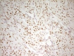 Invitrogen MEF2D Monoclonal Antibody (OTI3D12) 100 &mu;L; Unconjugated:Antibodies,