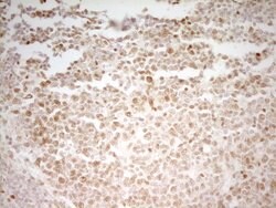 Invitrogen MEF2D Monoclonal Antibody (OTI3D12) 100 &mu;L; Unconjugated:Antibodies,