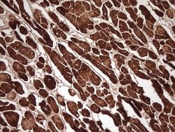 Invitrogen MYL4 Monoclonal Antibody (OTI1H6) 100 &mu;L; Unconjugated:Antibodies,