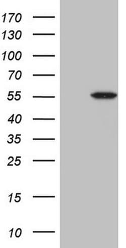 Invitrogen Myostatin Monoclonal Antibody (OTI3A7) 100 &mu;L; Unconjugated:Antibodies,