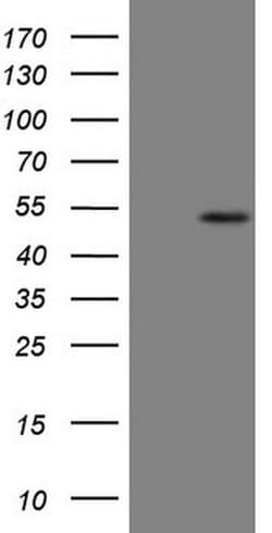 Invitrogen B4GALT4 Monoclonal Antibody (OTI8B6) 100 &mu;L; Unconjugated:Antibodies,