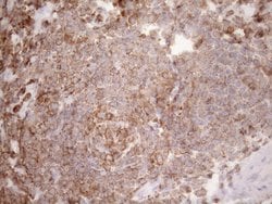 Invitrogen Kindlin 3 Monoclonal Antibody (OTI2G2) 100 &mu;L; Unconjugated:Antibodies,