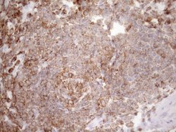 Invitrogen Kindlin 3 Monoclonal Antibody (OTI2G2) 100 &mu;L; Unconjugated:Antibodies,