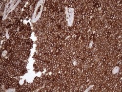 Invitrogen Kindlin 3 Monoclonal Antibody (OTI2G2) 100 &mu;L; Unconjugated:Antibodies,
