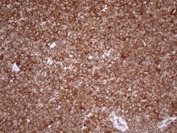 Invitrogen Kindlin 3 Monoclonal Antibody (OTI2G2) 100 &mu;L; Unconjugated:Antibodies,