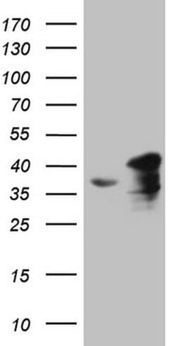 Invitrogen SPT3 Monoclonal Antibody (OTI3D1) 100 &mu;L; Unconjugated:Antibodies,