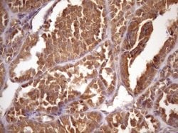 Invitrogen ASB2 Monoclonal Antibody (OTI2A2) 100 &mu;L; Unconjugated:Antibodies,
