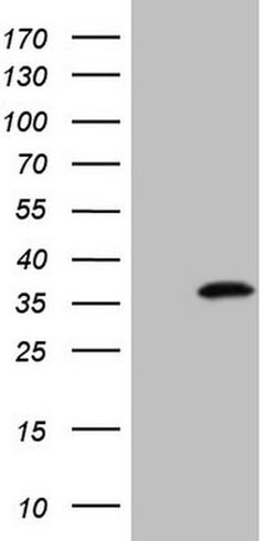 Invitrogen PRPK Monoclonal Antibody (OTI5A5) 100 &mu;L | Buy Online | Invitrogen&trade; | Fisher Scientific