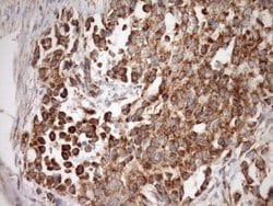 Invitrogen STOML2 Monoclonal Antibody (OTI1F5) 100 &mu;L; Unconjugated:Antibodies,