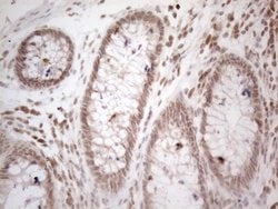 Invitrogen WTAP Monoclonal Antibody (OTI6H3) 100 &mu;L; Unconjugated:Antibodies,