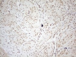 Invitrogen WTAP Monoclonal Antibody (OTI12G7) 100 &mu;L | Buy Online | Invitrogen&trade; | Fisher Scientific