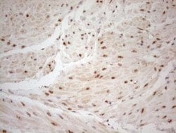 Invitrogen WTAP Monoclonal Antibody (OTI12G7) 100 &mu;L | Buy Online | Invitrogen&trade; | Fisher Scientific