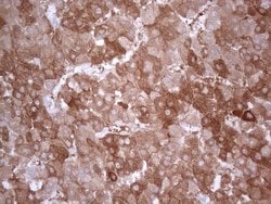 Invitrogen PPA2 Monoclonal Antibody (OTI7C1) 100 &mu;L; Unconjugated:Antibodies,