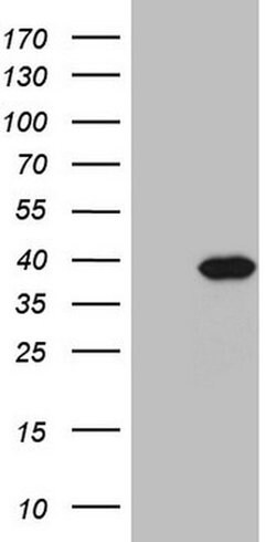 Invitrogen PPA2 Monoclonal Antibody (OTI7C1) 100 &mu;L; Unconjugated:Antibodies,