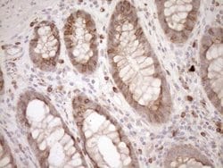 Invitrogen Melanophilin Monoclonal Antibody (OTI6E8) 100 &mu;L; Unconjugated:Antibodies,