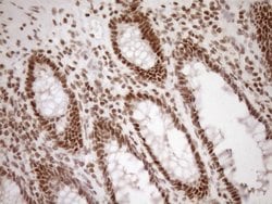 Invitrogen EXOSC1 Monoclonal Antibody (OTI1H9) 100 &mu;L; Unconjugated:Antibodies,