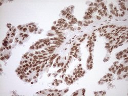 Invitrogen EXOSC1 Monoclonal Antibody (OTI1H9) 100 &mu;L; Unconjugated:Antibodies,