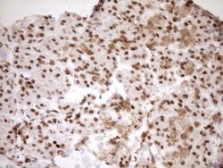 Invitrogen EXOSC1 Monoclonal Antibody (OTI1H9) 100 &mu;L; Unconjugated:Antibodies,