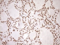Invitrogen EXOSC1 Monoclonal Antibody (OTI1H9) 100 &mu;L; Unconjugated:Antibodies,
