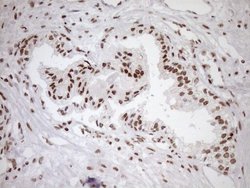 Invitrogen EXOSC1 Monoclonal Antibody (OTI1H9) 100 &mu;L; Unconjugated:Antibodies,