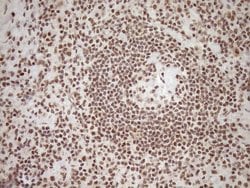 Invitrogen EXOSC1 Monoclonal Antibody (OTI1H9) 100 &mu;L; Unconjugated:Antibodies,