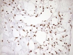 Invitrogen EXOSC1 Monoclonal Antibody (OTI1H9) 100 &mu;L; Unconjugated:Antibodies,