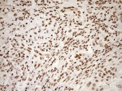 Invitrogen EXOSC1 Monoclonal Antibody (OTI1H9) 100 &mu;L; Unconjugated:Antibodies,