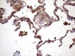 Invitrogen CHMP5 Monoclonal Antibody (OTI5C7) 100 &mu;L; Unconjugated:Antibodies,
