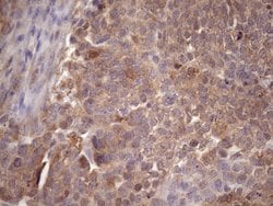 Invitrogen CHMP5 Monoclonal Antibody (OTI5C7) 100 &mu;L; Unconjugated:Antibodies,