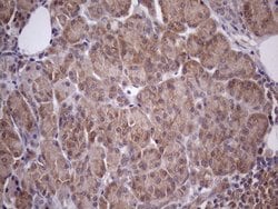 Invitrogen CHMP5 Monoclonal Antibody (OTI5C7) 100 &mu;L; Unconjugated:Antibodies,