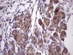 Invitrogen CHMP5 Monoclonal Antibody (OTI5C7) 100 &mu;L; Unconjugated:Antibodies,