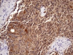 Invitrogen CHMP5 Monoclonal Antibody (OTI5C7) 100 &mu;L; Unconjugated:Antibodies,