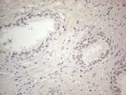 Invitrogen ERCC8 Monoclonal Antibody (OTI2G1) 100 &mu;L; Unconjugated:Antibodies,