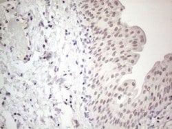 Invitrogen ERCC8 Monoclonal Antibody (OTI2G1) 100 &mu;L; Unconjugated:Antibodies,