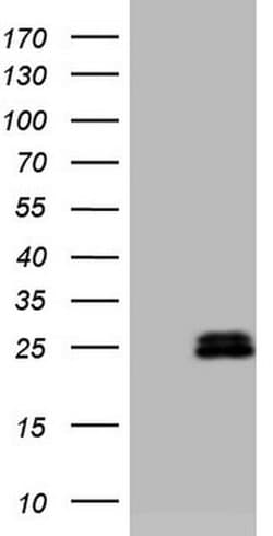 Invitrogen AMTN Monoclonal Antibody (OTI2D9) 100 &mu;L; Unconjugated:Antibodies,