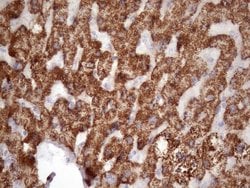 Invitrogen GLYAT Monoclonal Antibody (OTI4D1) 100 &mu;L; Unconjugated:Antibodies,
