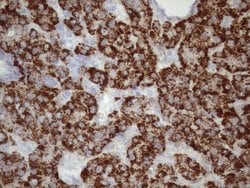 Invitrogen GLYAT Monoclonal Antibody (OTI4D1) 100 &mu;L; Unconjugated:Antibodies,