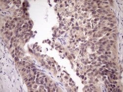 Invitrogen ZNF449 Monoclonal Antibody (OTI4C6) 100 &mu;L; Unconjugated:Antibodies,