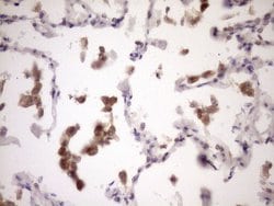Invitrogen ZNF449 Monoclonal Antibody (OTI4C6) 100 &mu;L; Unconjugated:Antibodies,